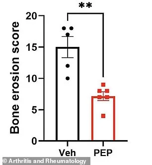 Hope for Arthritis: Peptide Therapy Offers Effective, Targeted Treatment