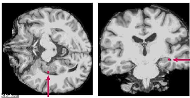 Scientists Discover Brain Processes Language While Unconscious Near Death